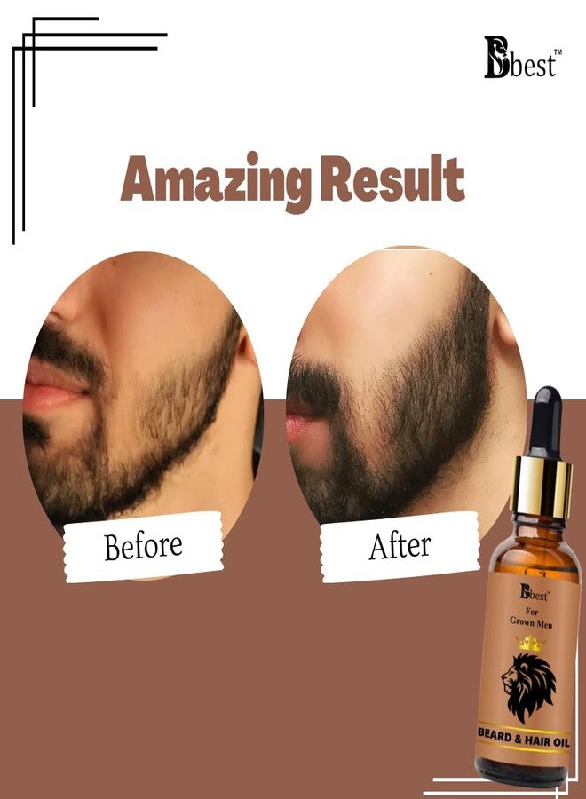 BBest Beard Growth Oil - 30 ml Pack of 3) | With Redensyl & 15 Natural Oils Including Jojoba, Almond & Vitamin E | Boosts Beard Growth, Strengthens Hair & Nourishes Roots | No Harmful Chemicals - Image 3